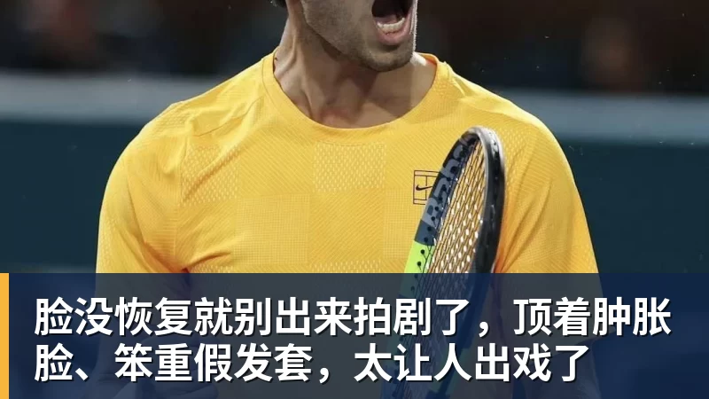 超凡国际脸没恢复就别出来拍剧了，顶着肿胀脸、笨重假发套，太让人出戏了